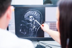 What You Need to Prove Your Traumatic Brain Injury