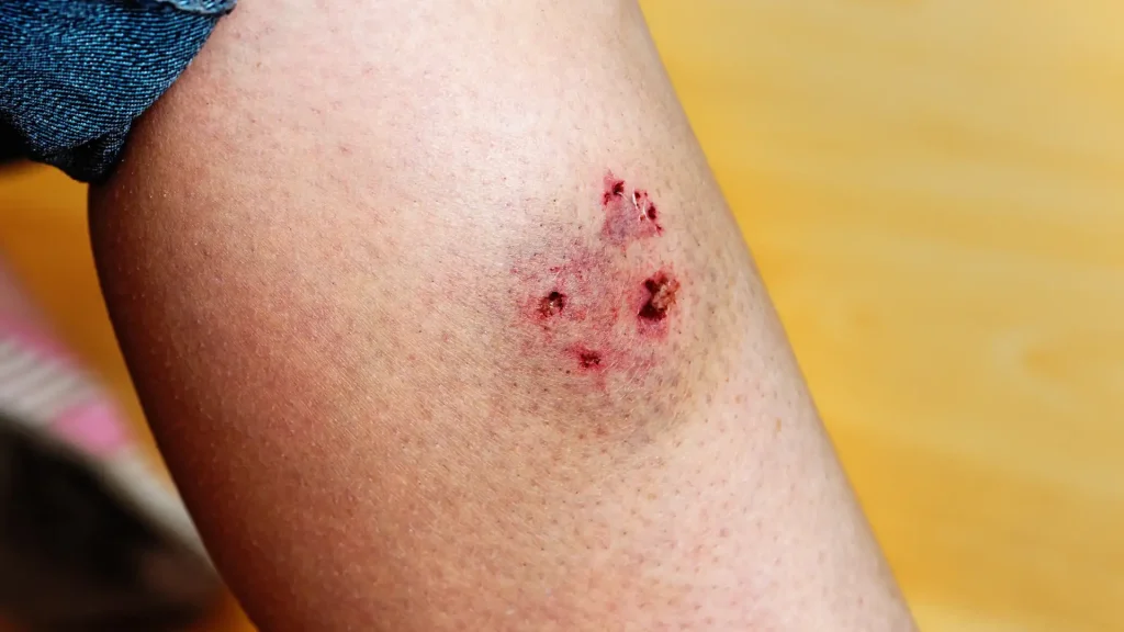 What Happens After a Dog Bite in Houston_ A Legal Guide image 2